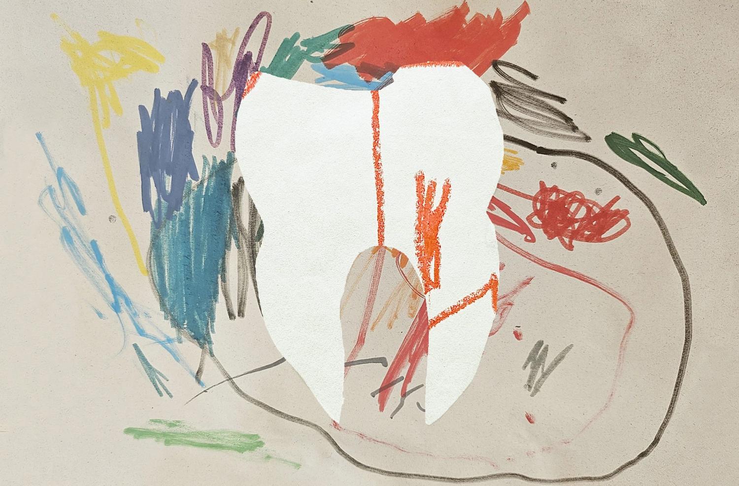 Fiesta De Pijamas Con Caries Y La Actuación De Dear Joanne