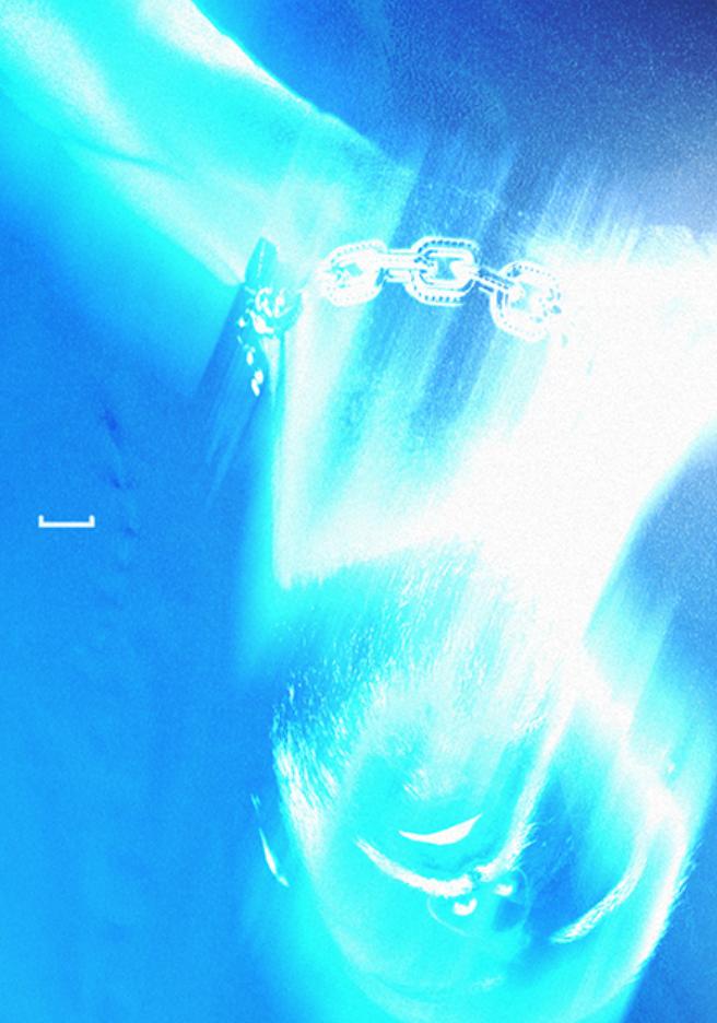 [Sic]: Oyuki / Celice / Ursula Prawn