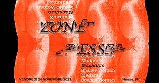 Zone Fesses